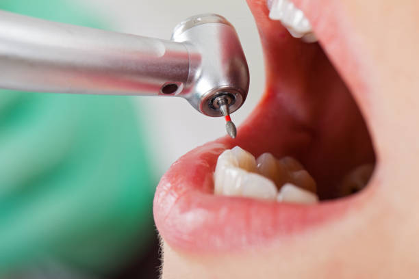 Best Emergency Root Canal Treatment in Innsbrook, VA